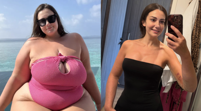 Influencer de ‘body positive’ recibe críticas tras bypass gástrico
