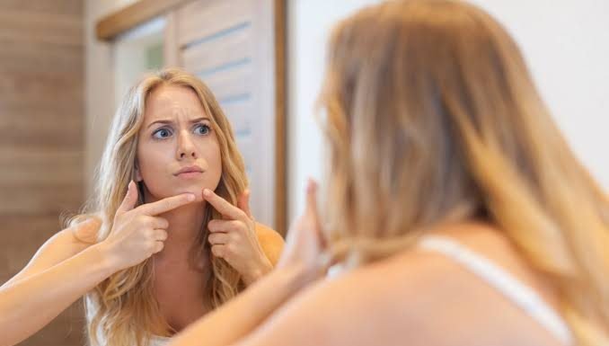 Acné en la adultez: afecta mucho más de lo que parece, ¿por qué?