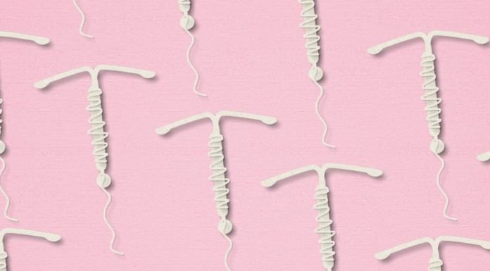 ¿El DIU se mueve durante el sexo? Lo que dice la anatomía